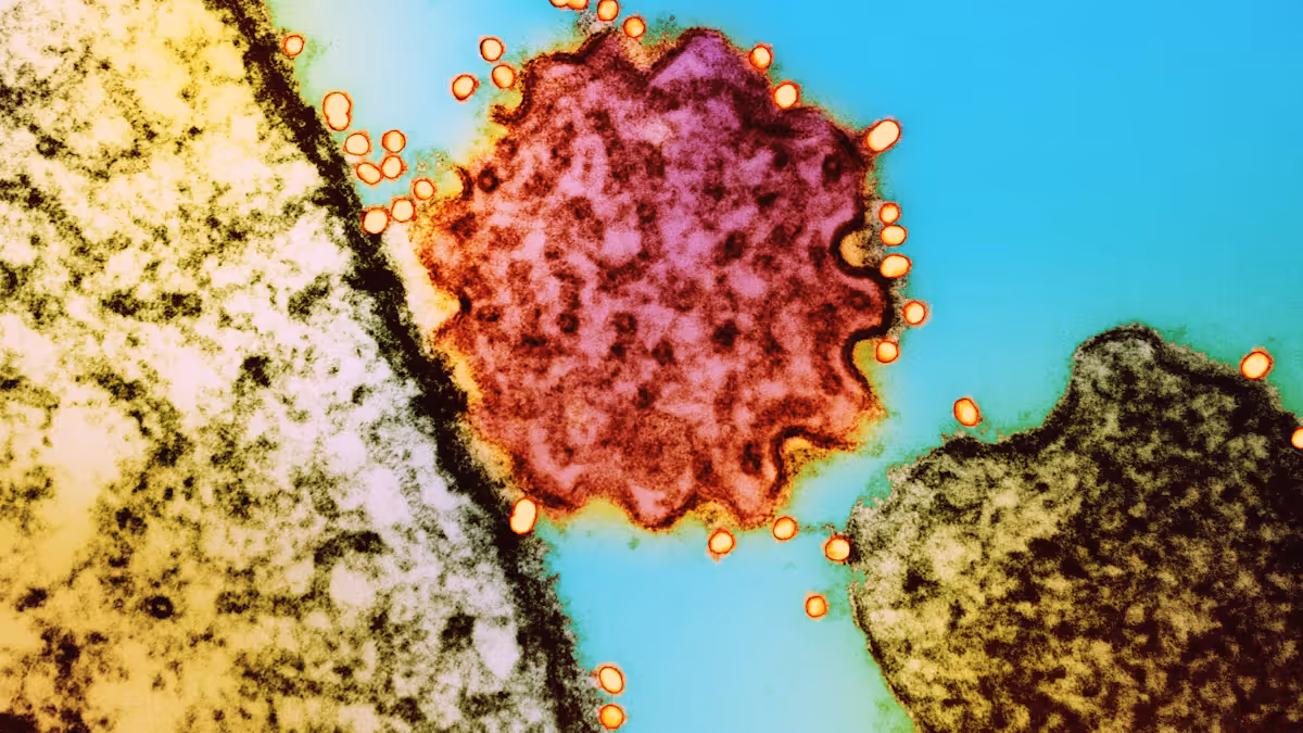 عام — Why is India’s Nipah virus outbreak spooking the world? - Al Jazeera