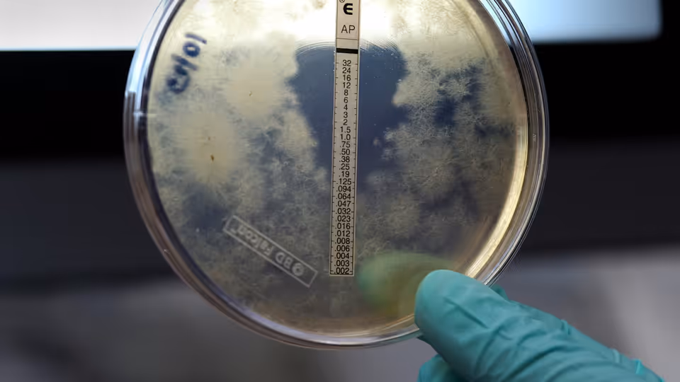 عام — Meningitis cases rise in major Midwestern city, prompting public health alert - Fox News