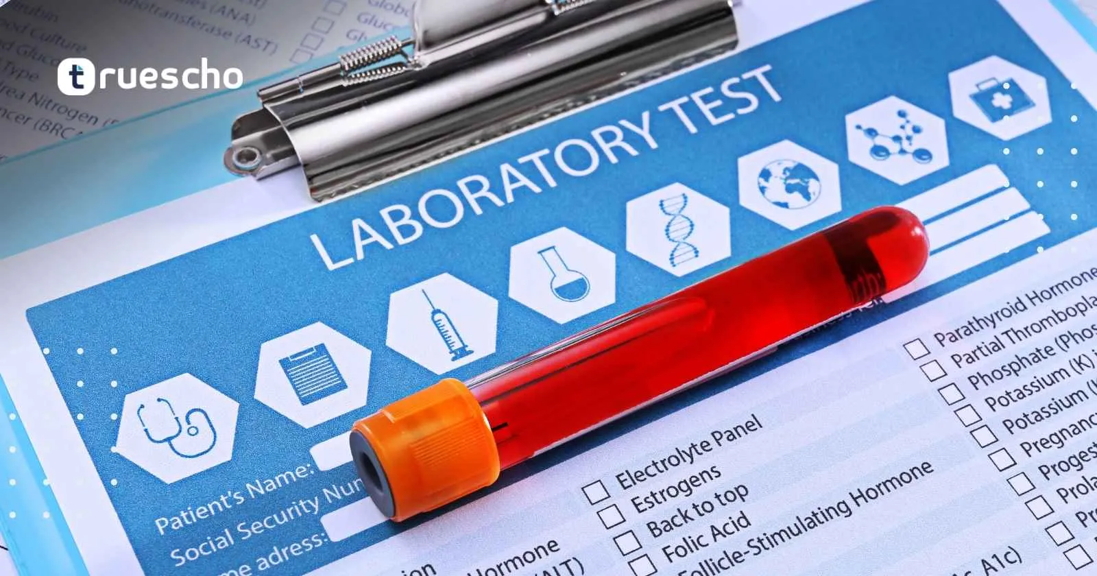 تحاليل قبل استخدام إبر أوزمبك