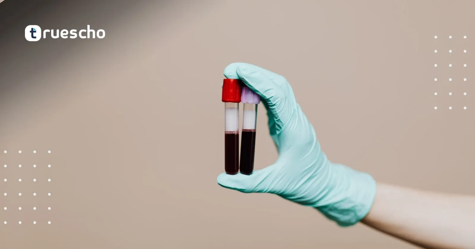 تحاليل المرارة