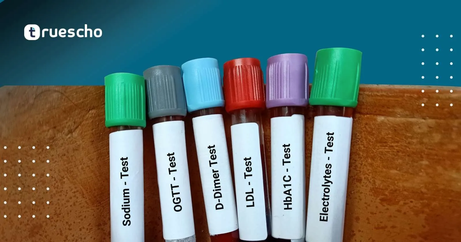 تحاليل الحمل