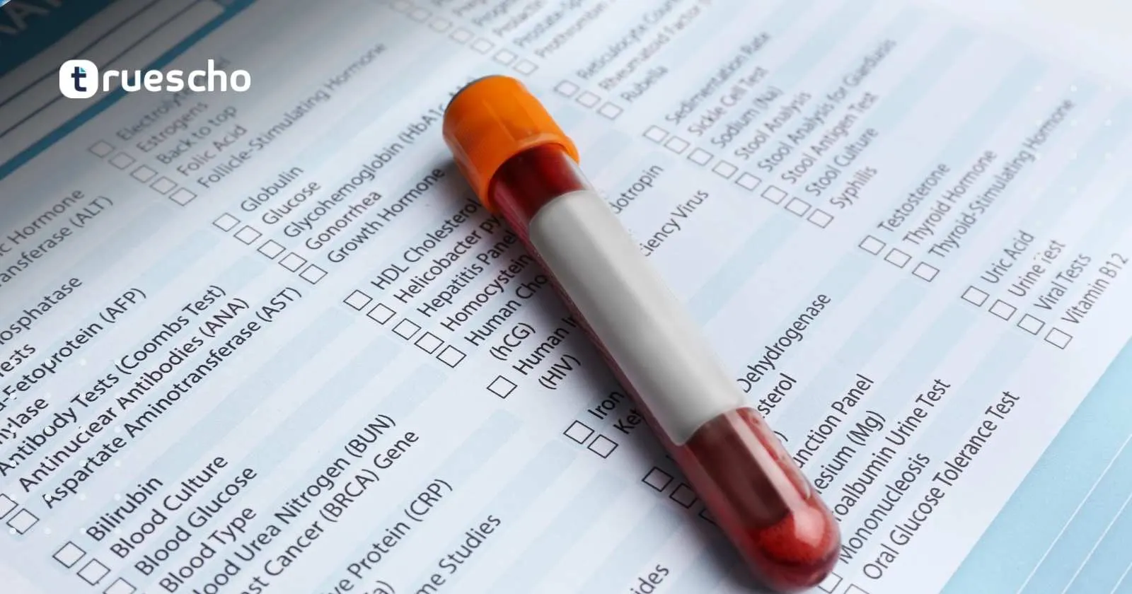 تحاليل الدهون