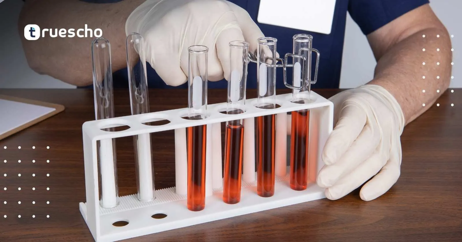 ترجمة التحاليل الطبية بالكاميرا عبر الجوال