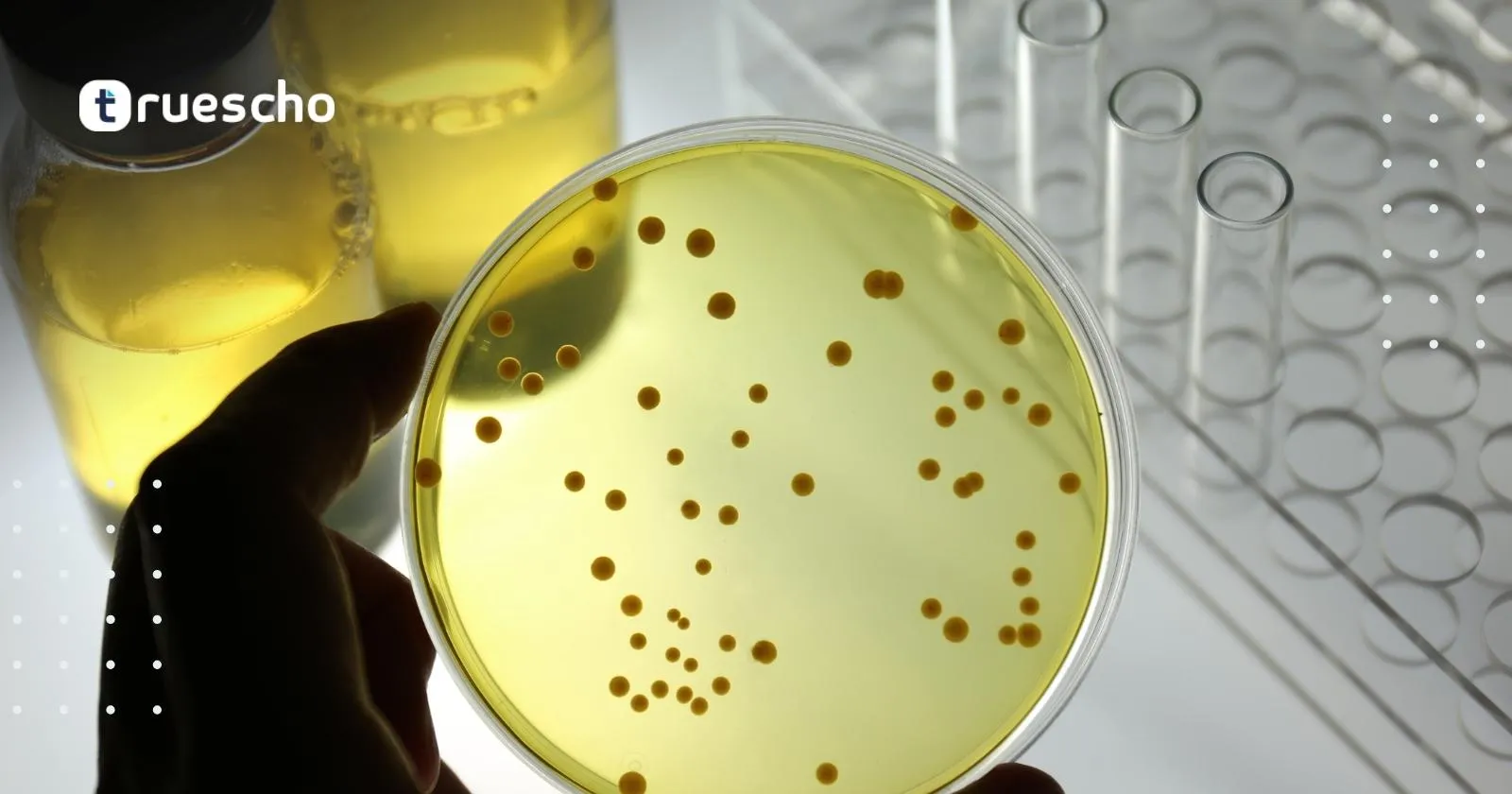 تحاليل الفيروسات